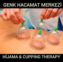 Genk Hacamat Merkezi Hijama en Cupping Therapy, openingstijden