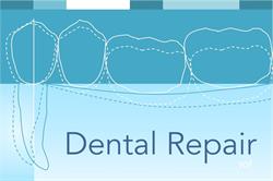 Dental Repair vof, Balen openingstijden