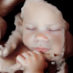 Echo 3D passion - Echographie 3D, 2D, 4D Affective, Moeskroen openingstijden